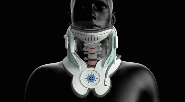 Alpha Medical Elektronická trakční ortéza na krk 33